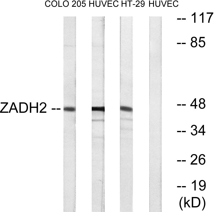 ZADH2 Rabbit Polyclonal Antibody