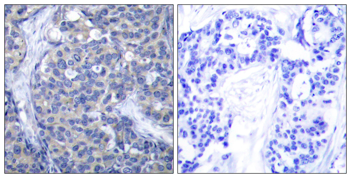 ZAP-70 Rabbit Polyclonal Antibody