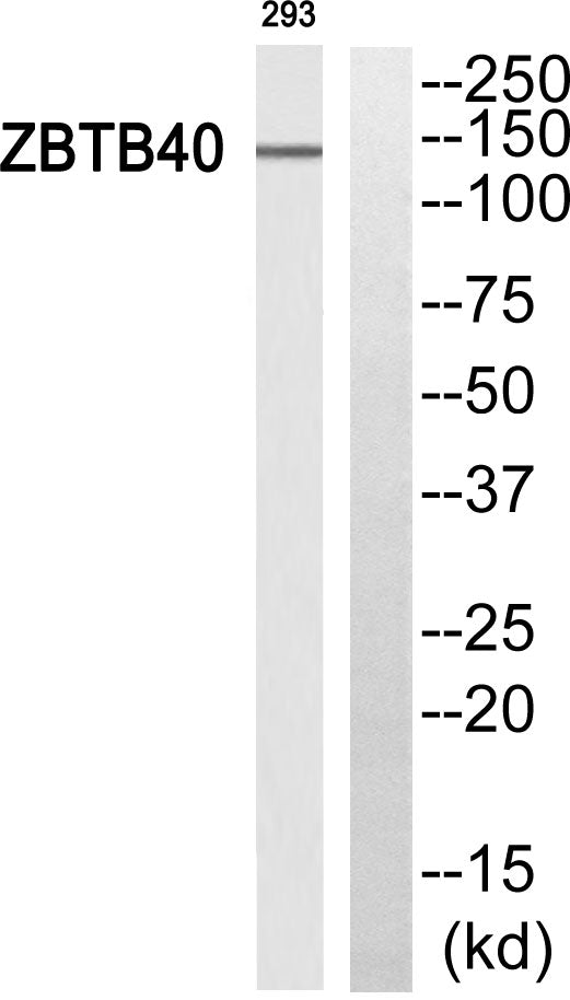 ZBTB40 Rabbit Polyclonal Antibody