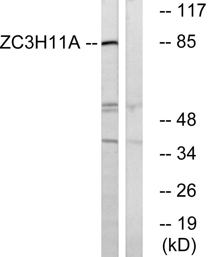 ZC3H11A Rabbit Polyclonal Antibody