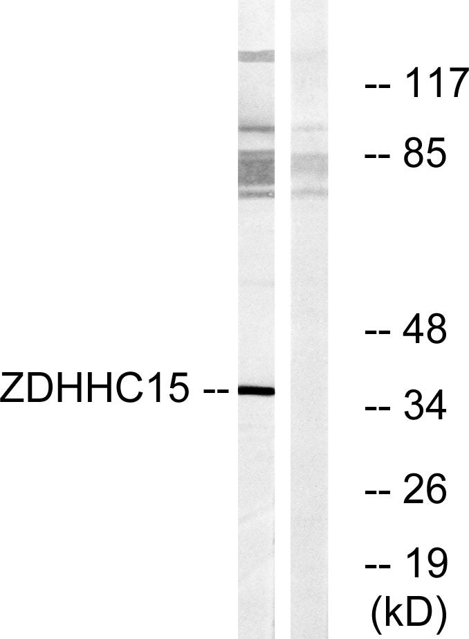 ZDHHC15 Rabbit Polyclonal Antibody
