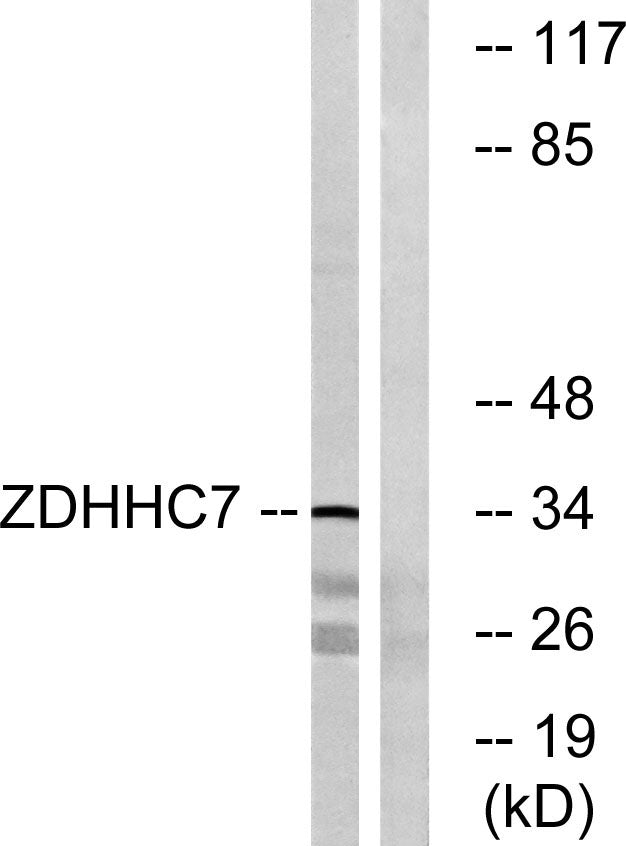 ZDHHC7 Rabbit Polyclonal Antibody