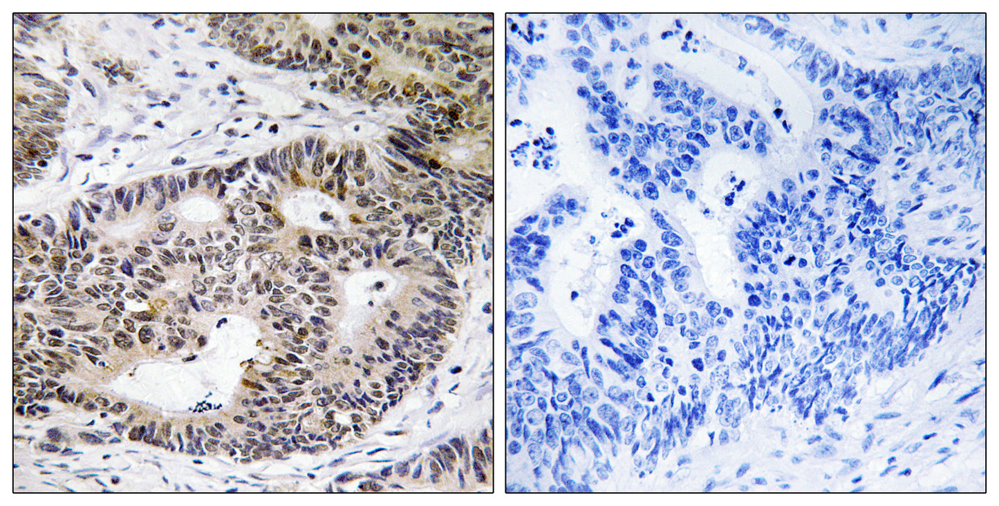 ZFYVE19 Rabbit Polyclonal Antibody
