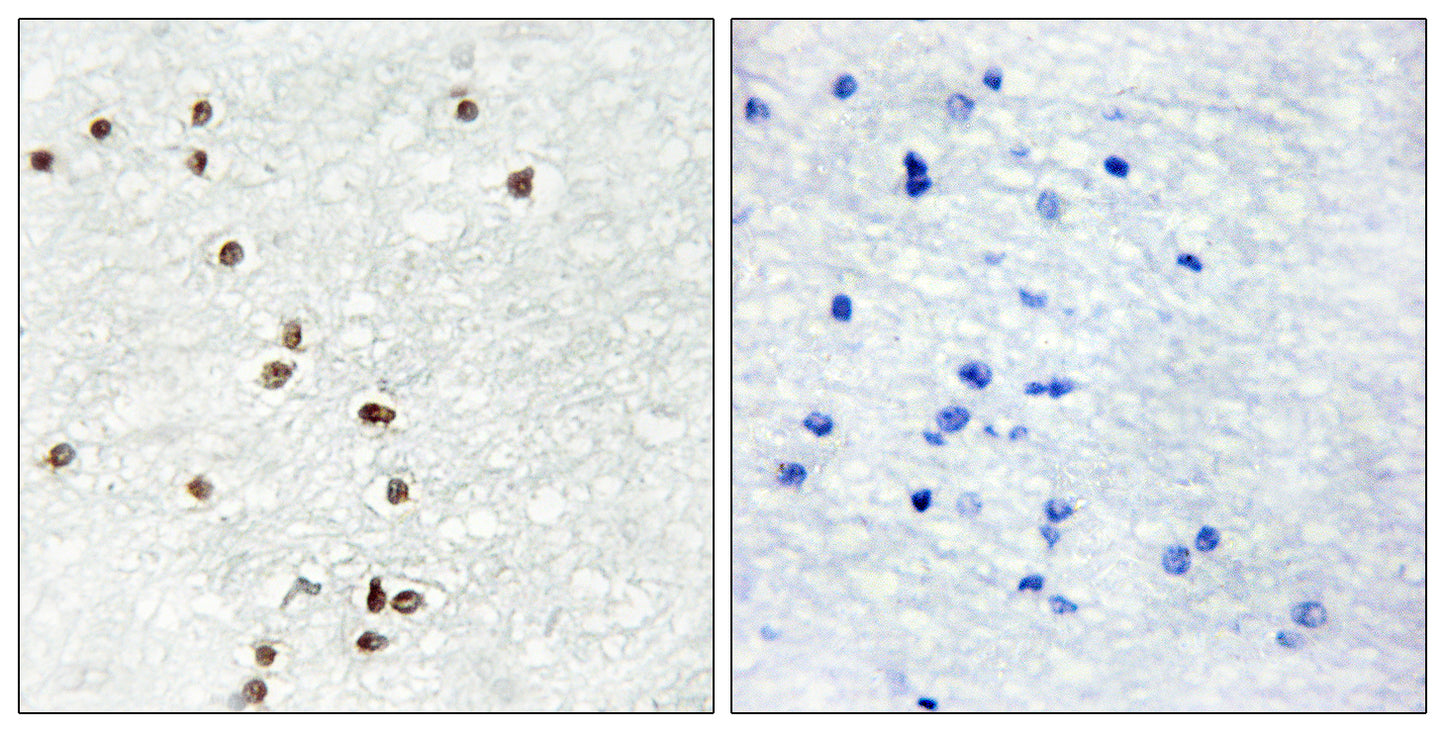Zic1/2/3 Rabbit Polyclonal Antibody