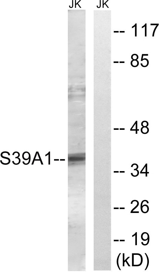 ZIP1 Rabbit Polyclonal Antibody