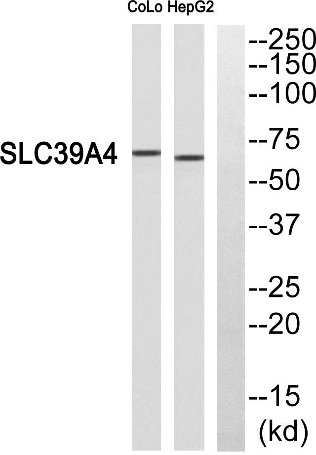 ZIP4 Rabbit Polyclonal Antibody