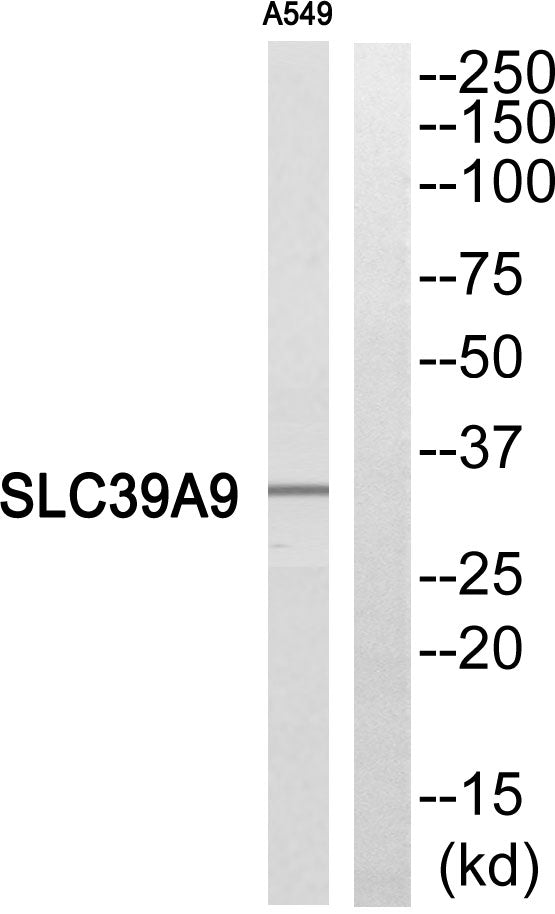 ZIP9 Rabbit Polyclonal Antibody