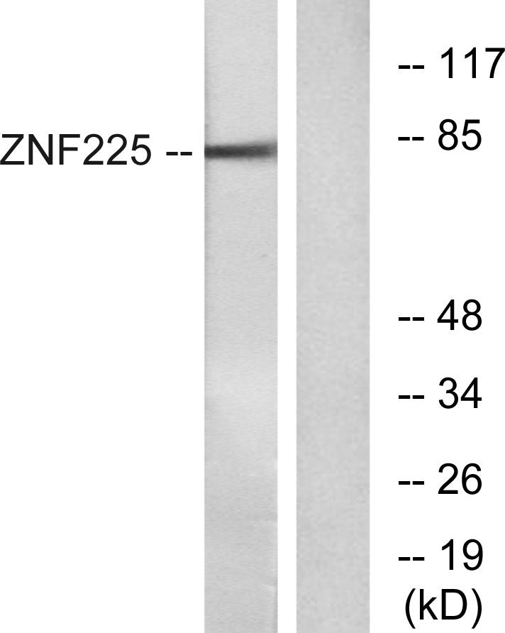 ZNF225 Rabbit Polyclonal Antibody