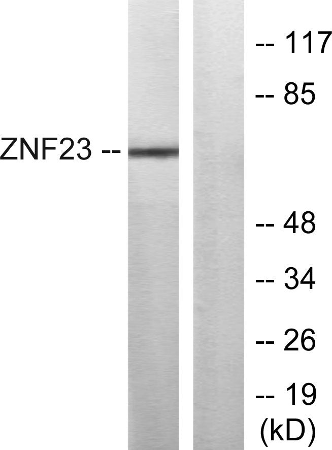ZNF23 Rabbit Polyclonal Antibody