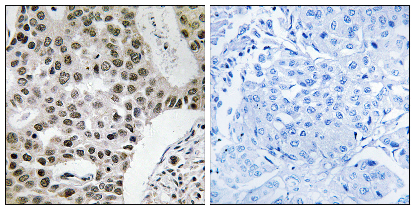 ZNF262 Rabbit Polyclonal Antibody