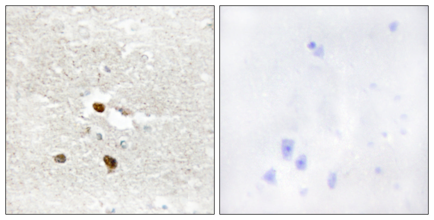 ZNF287 Rabbit Polyclonal Antibody