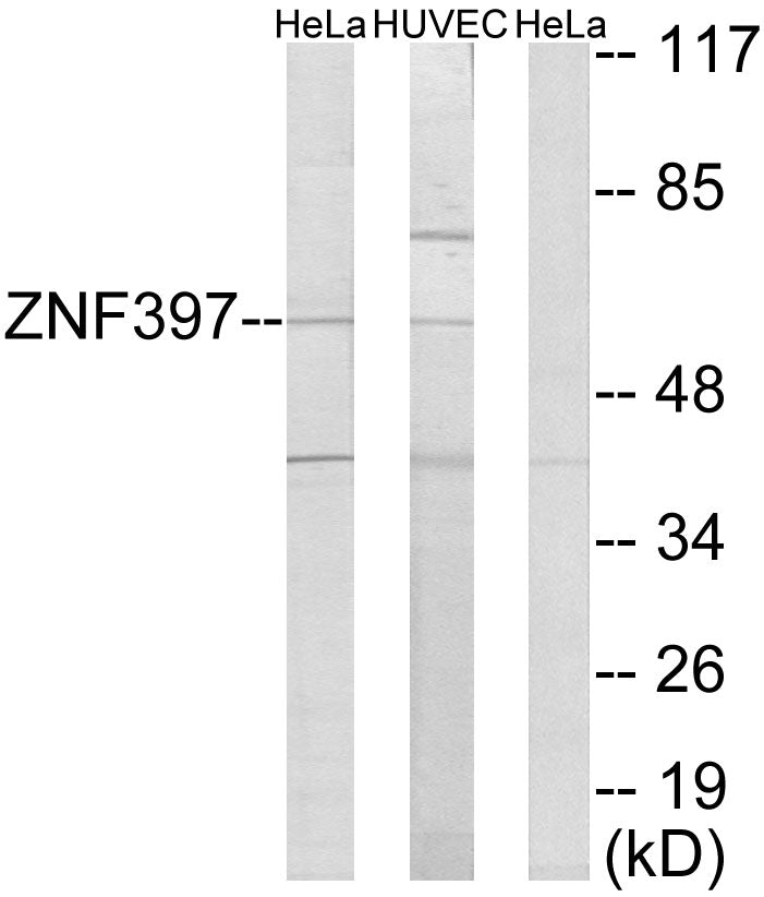 ZNF397 Rabbit Polyclonal Antibody