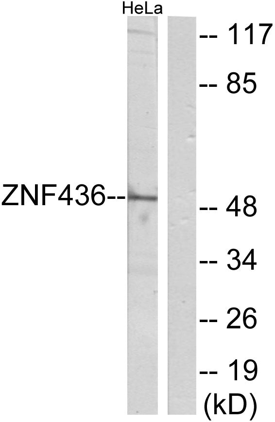 ZNF436 Rabbit Polyclonal Antibody