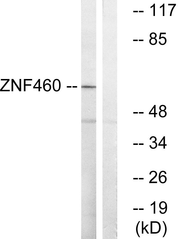 ZNF460 Rabbit Polyclonal Antibody