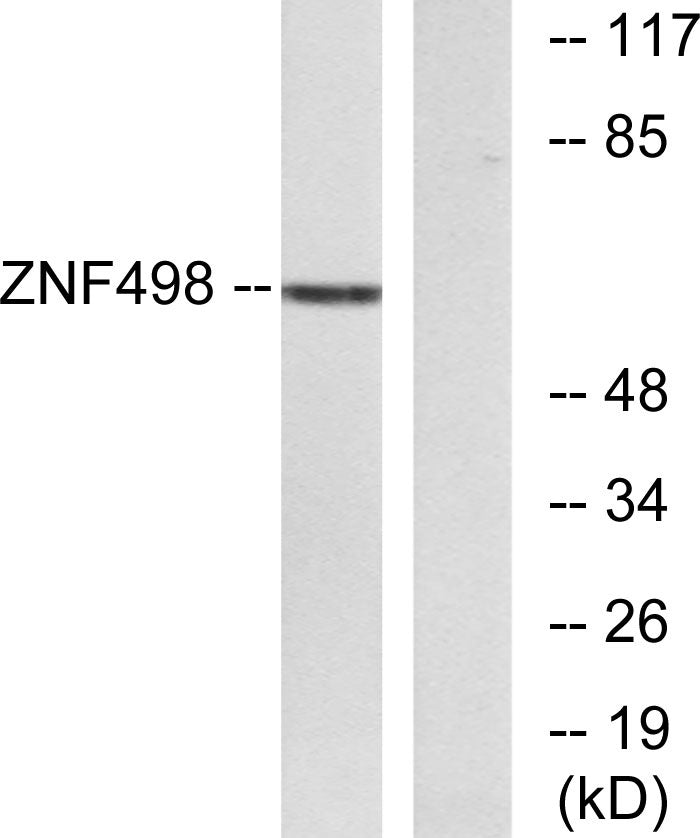 ZNF498 Rabbit Polyclonal Antibody