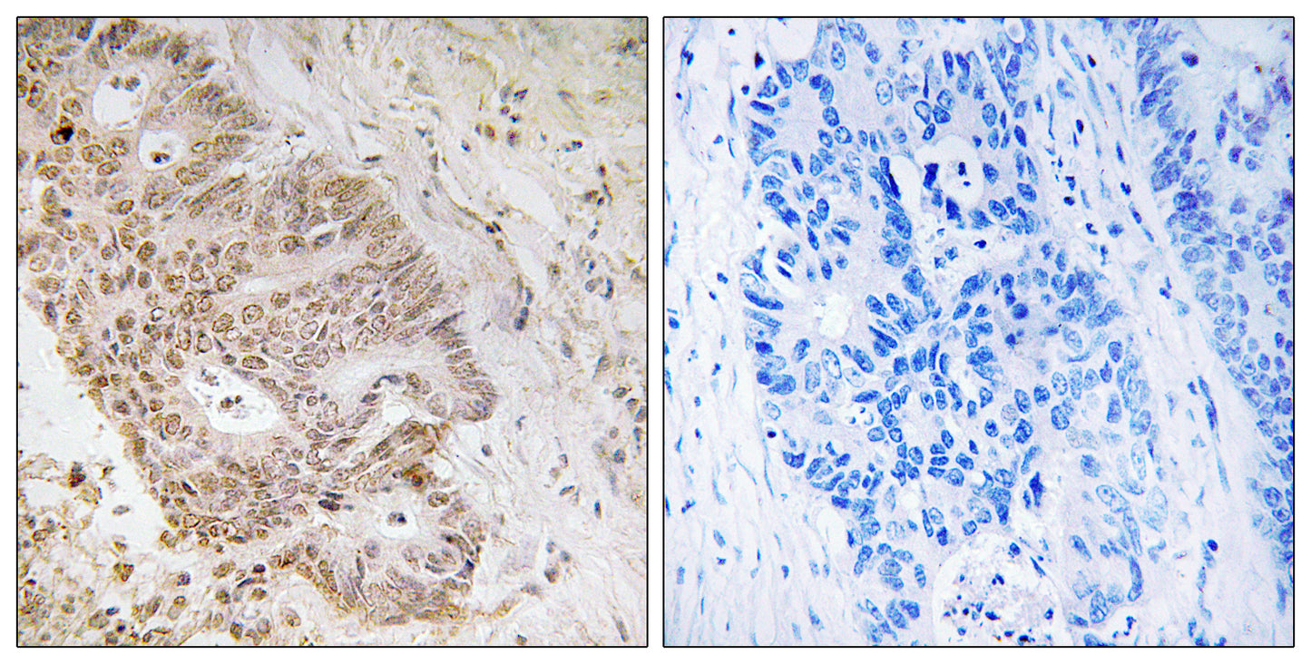 ZNF592 Rabbit Polyclonal Antibody