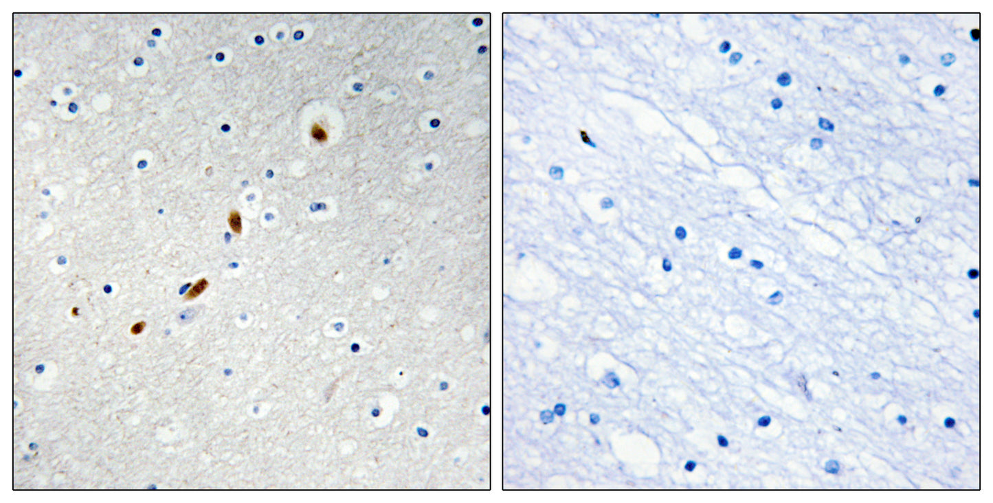 ZNF596 Rabbit Polyclonal Antibody