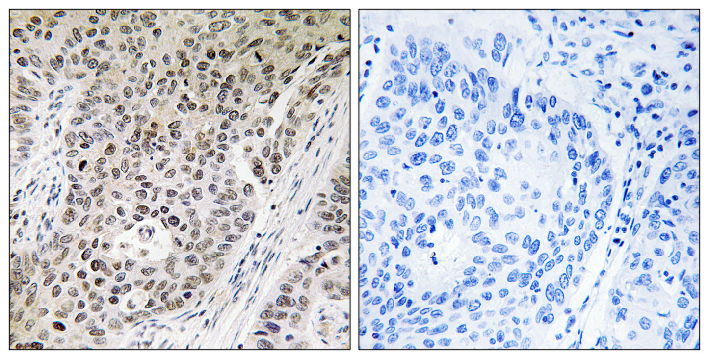 ZNF608 Rabbit Polyclonal Antibody
