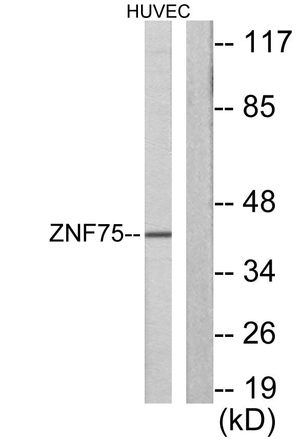 ZNF75 Rabbit Polyclonal Antibody
