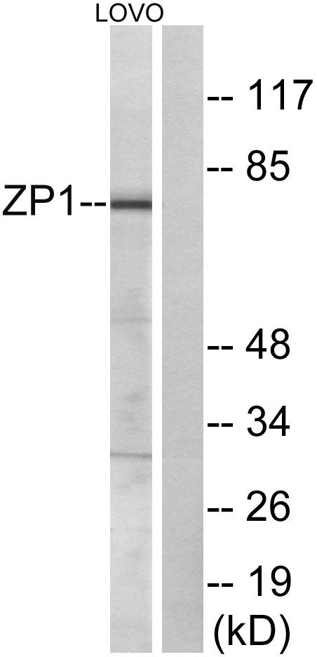 ZP1 Rabbit Polyclonal Antibody