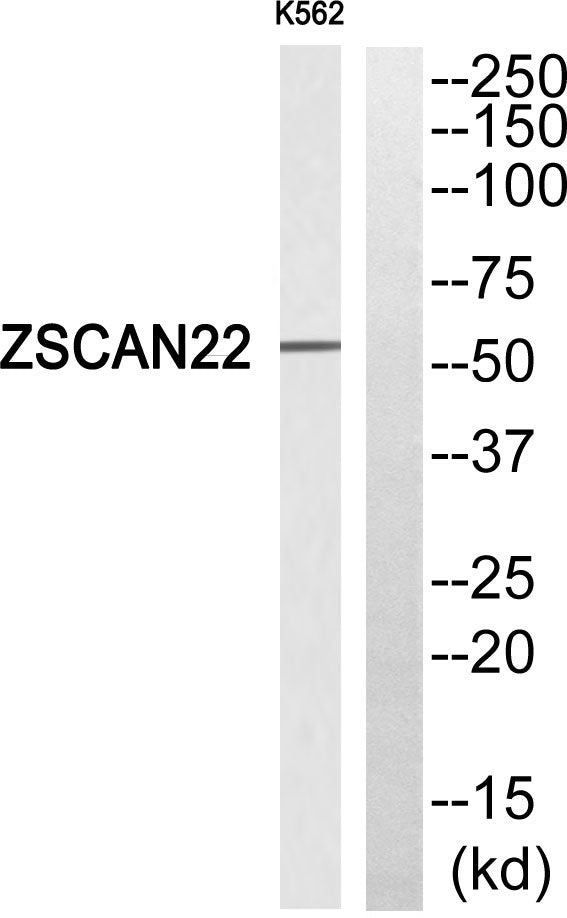 ZSCAN22 Rabbit Polyclonal Antibody