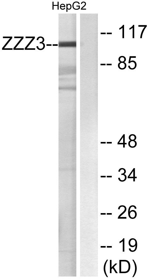 ZZZ3 Rabbit Polyclonal Antibody