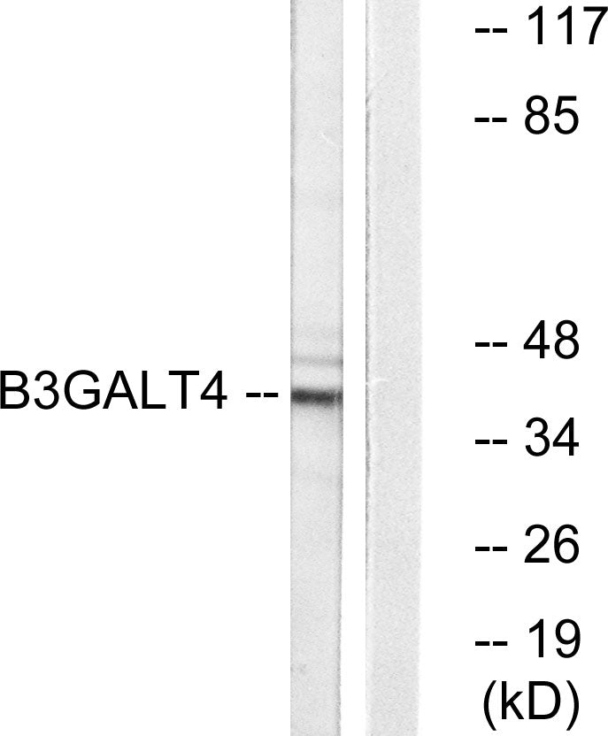 β-1,3-Gal-T4 Rabbit Polyclonal Antibody