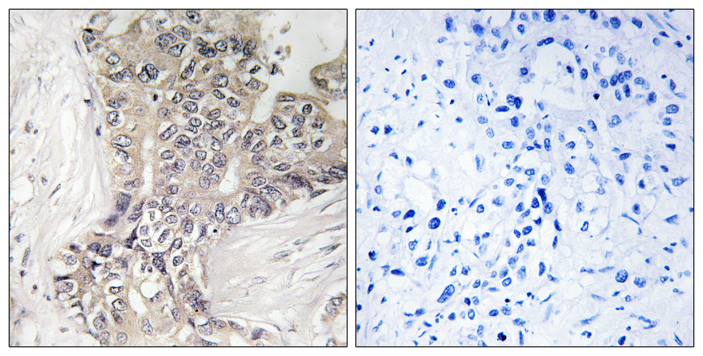 β-1,3-Gal-TL Rabbit Polyclonal Antibody