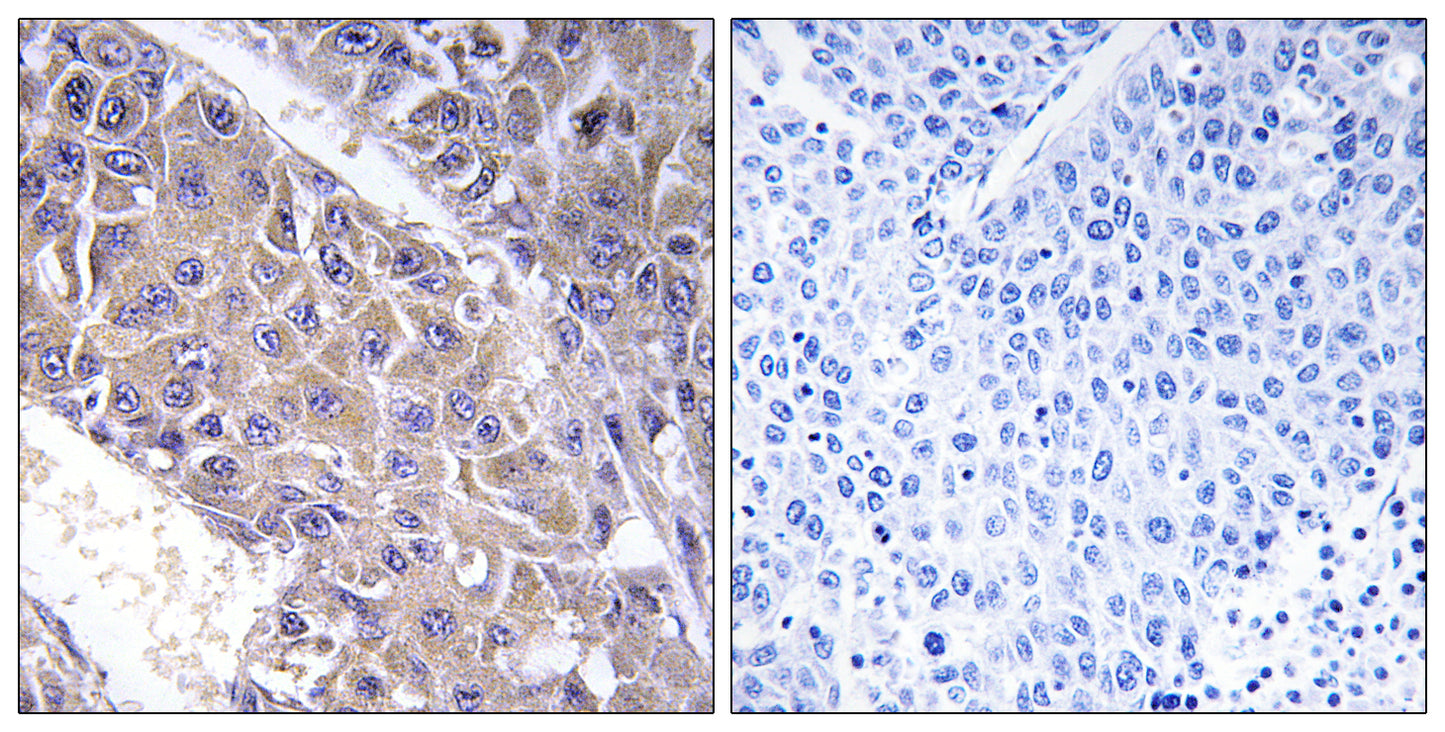 β-1,4-Gal-T3 Rabbit Polyclonal Antibody