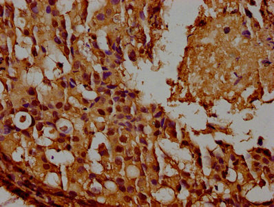 GAPDH Monoclonal Antibody