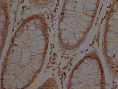 ACTB Monoclonal Antibody