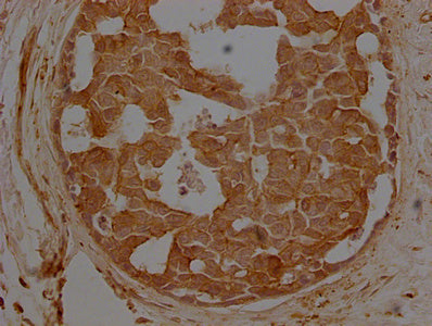 ACTB Monoclonal Antibody