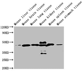 ACTB Monoclonal Antibody