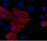 His-Tag Monoclonal Antibody