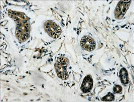 TUBB3 Monoclonal Antibody