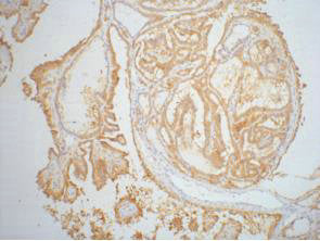 LGALS3 Monoclonal Antibody