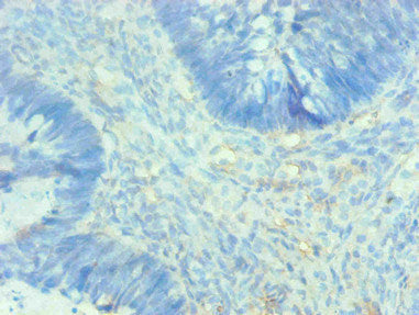 AHSG Monoclonal Antibody
