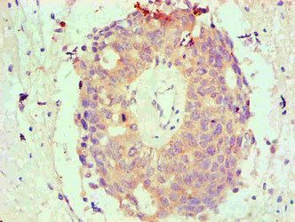BCL2L1 Monoclonal Antibody
