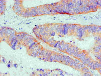 BCL2L1 Monoclonal Antibody