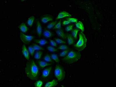 CD14 Monoclonal Antibody