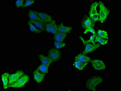 CD14 Monoclonal Antibody
