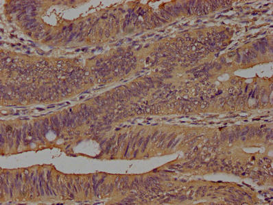 CD14 Monoclonal Antibody