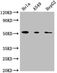 CD14 Monoclonal Antibody