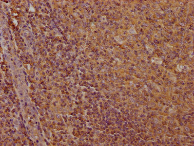 CD19 Monoclonal Antibody