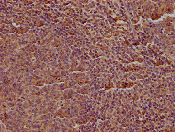 CD19 Monoclonal Antibody