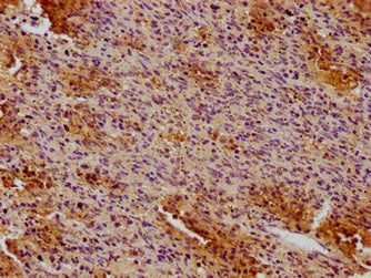 CD19 Monoclonal Antibody