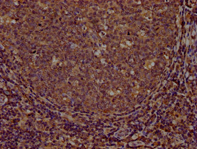 CD44 Monoclonal Antibody