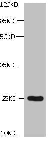 CD59 Monoclonal Antibody