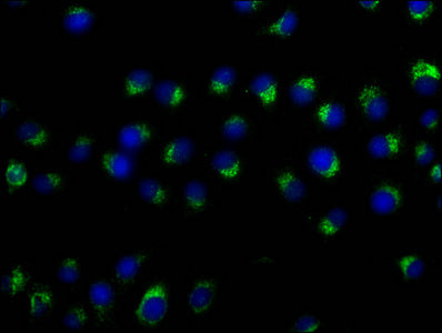 CD63 Monoclonal Antibody