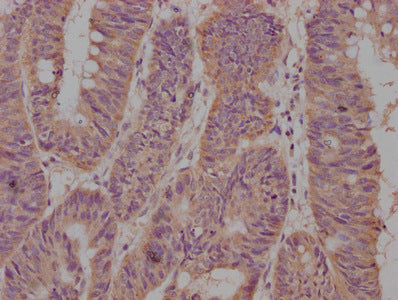 CD63 Monoclonal Antibody